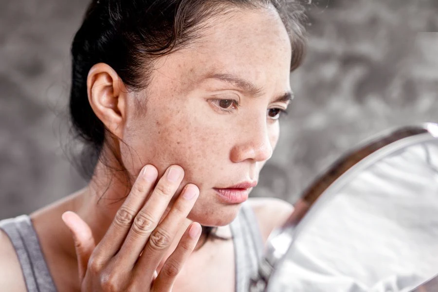 ĐẨY LÙI NÁM, TÀN NHANG, CHỊ EM U40 TƯƠI TRẺ RẠNG RỠ NHƯ MỚI DẬY THÌ